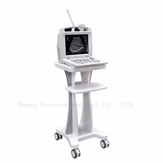 Ce Approved Hospital Equipment Sonar Baby Monitor Portable Ultrasound (YJ